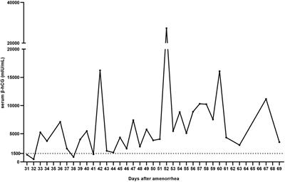 Case Report: Ovarian pregnancy, a rare but lethal condition: An analysis of 112 cases